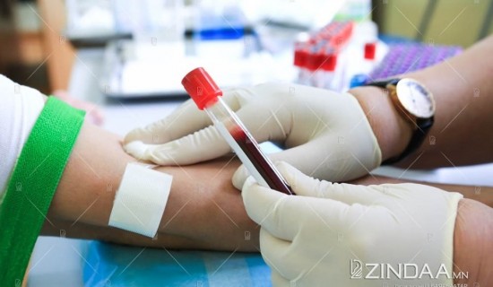 Төв эмнэлэгт В, С, Дельта вирусийн шинжилгээг хийж байна